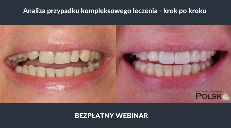 krok po kroku